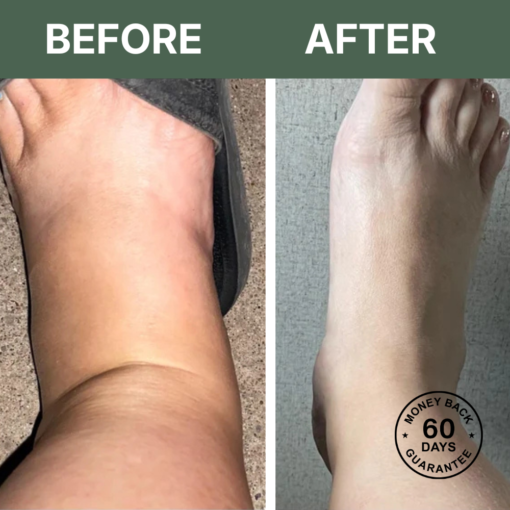 LymphaFlow™ Pro – Natural Relief for Swollen Legs In Just 15 Minutes A Day!