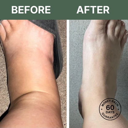 LymphaFlow™ Pro – Natural Relief for Swollen Legs In Just 15 Minutes A Day!