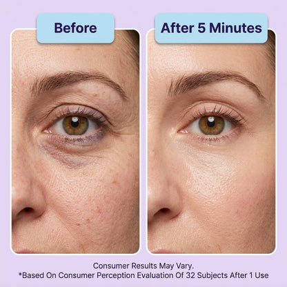 Your Younger-Looking Eyes Are 5 Minutes Away With PURELYFT™