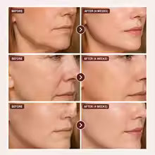 NAD Wrinkle Serum